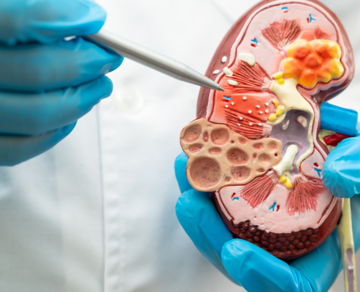Nephrology_1